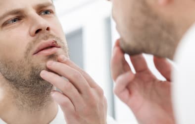 An image of a man looking at a cold sore on his lips in the mirror.